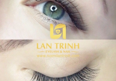 Lan Trinh tự hào là nơi tiên phòng cho phương pháp NÔI MI ĐẸP AN TOÀN tại VIỆT NAM